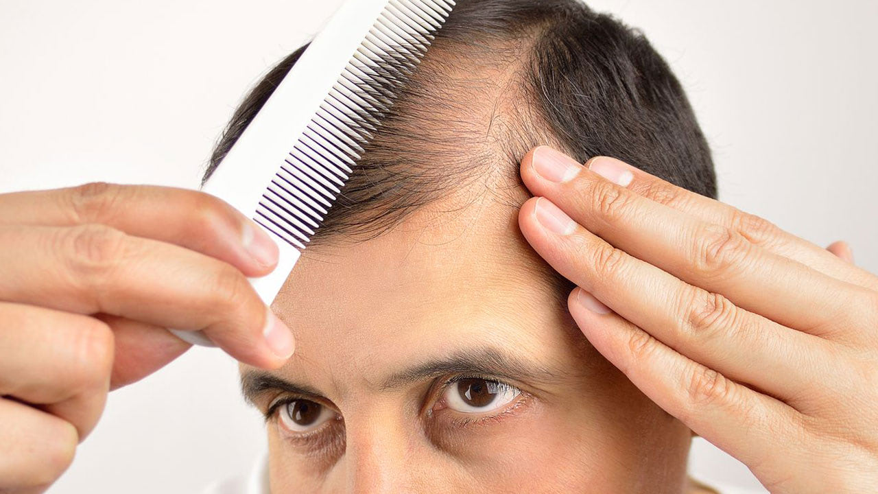 A man with thinning hair uses a white comb to part his hair, while touching his scalp with his other hand, highlighting men’s hair loss on the top of his head.