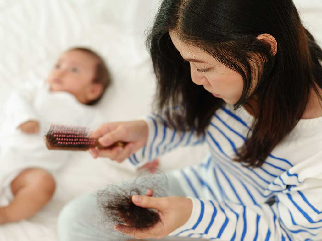 How To Deal With Hair Loss After Pregnancy