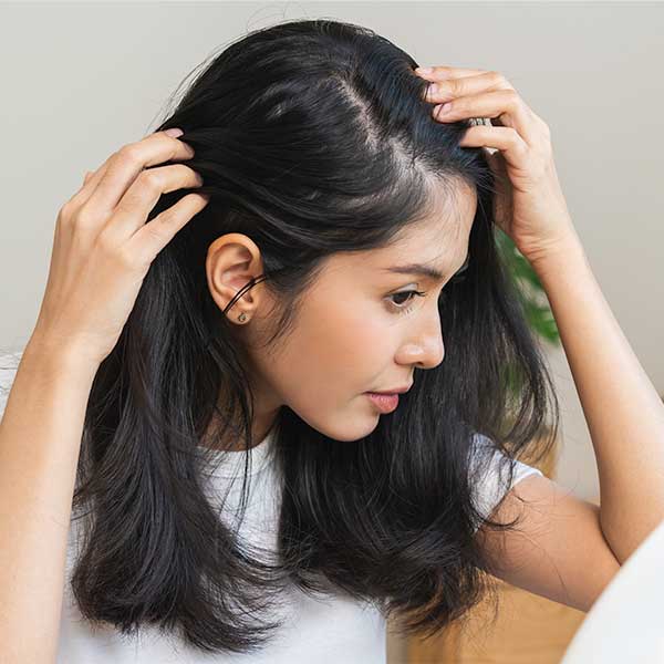 woman with thinning hair